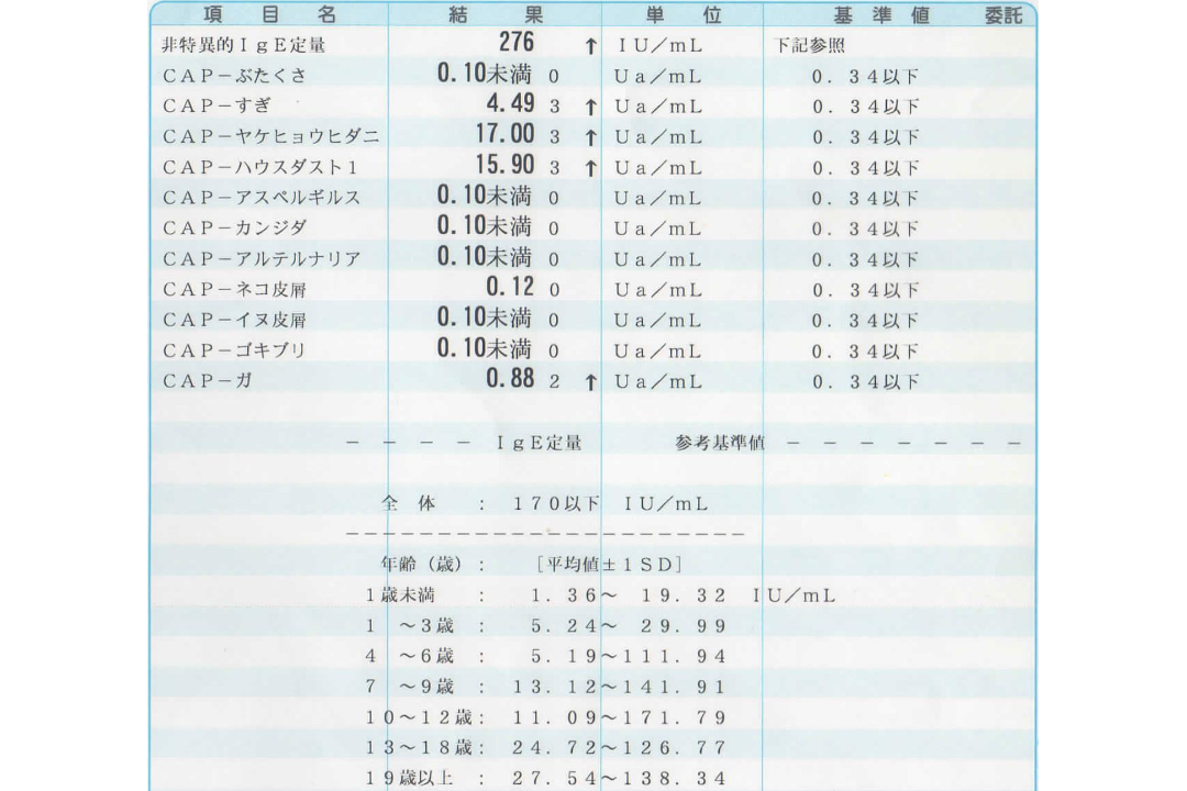 アレルギー血液検査の結果